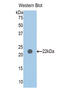 Pappalysin-2 antibody, LS-C373151, Lifespan Biosciences, Western Blot image 