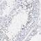 Sperm Acrosome Associated 3 antibody, NBP1-89136, Novus Biologicals, Immunohistochemistry paraffin image 