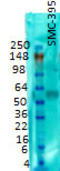 Solute Carrier Family 17 Member 6 antibody, TA326590, Origene, Western Blot image 