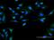 SPO11 Initiator Of Meiotic Double Stranded Breaks antibody, H00023626-D01P, Novus Biologicals, Immunocytochemistry image 