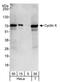 Centromere Protein E antibody, NBP1-06506, Novus Biologicals, Western Blot image 