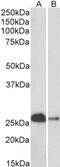 Calbindin 1 antibody, MBS423038, MyBioSource, Western Blot image 