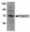 Forkhead Box O1 antibody, TA319651, Origene, Western Blot image 