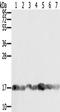 Peptidyl-prolyl cis-trans isomerase A antibody, TA350296, Origene, Western Blot image 