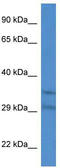 Solute Carrier Family 25 Member 31 antibody, TA335356, Origene, Western Blot image 