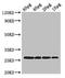 Ribosomal Protein S2 antibody, LS-C211785, Lifespan Biosciences, Western Blot image 