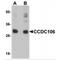 Coiled-coil domain-containing protein 106 antibody, MBS150909, MyBioSource, Western Blot image 