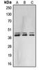 Mitogen-Activated Protein Kinase 1 antibody, orb214452, Biorbyt, Western Blot image 
