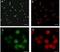 Transient Receptor Potential Cation Channel Subfamily V Member 1 antibody, NB100-1617, Novus Biologicals, Immunocytochemistry image 