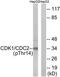 Cyclin Dependent Kinase 2 antibody, TA313152, Origene, Western Blot image 