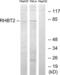Rho Related BTB Domain Containing 2 antibody, abx013782, Abbexa, Western Blot image 