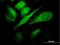 TBC1 Domain Family Member 8 antibody, H00011138-M02, Novus Biologicals, Immunofluorescence image 