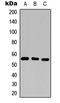 CD25 antibody, LS-C356133, Lifespan Biosciences, Western Blot image 