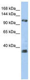 Zinc Finger E-Box Binding Homeobox 2 antibody, TA334226, Origene, Western Blot image 