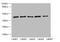 Ribonucleotide Reductase Regulatory Subunit M2 antibody, A56054-100, Epigentek, Western Blot image 