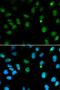 Deoxycytidine kinase antibody, LS-B11915, Lifespan Biosciences, Immunofluorescence image 