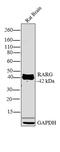 Retinoic Acid Receptor gamma-1 antibody, PA3-813, Invitrogen Antibodies, Western Blot image 