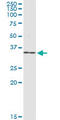 Nuclear Receptor Subfamily 0 Group B Member 2 antibody, LS-C198561, Lifespan Biosciences, Western Blot image 