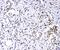 Promyelocytic Leukemia antibody, PB10084, Boster Biological Technology, Immunohistochemistry paraffin image 