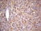 Insulin Like Growth Factor 1 antibody, M00148-1, Boster Biological Technology, Immunohistochemistry paraffin image 