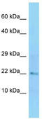 Cofilin 2 antibody, TA346655, Origene, Western Blot image 