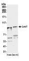 LEO1 Homolog, Paf1/RNA Polymerase II Complex Component antibody, A300-175A, Bethyl Labs, Western Blot image 