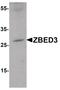 Zinc Finger BED-Type Containing 3 antibody, PA5-20767, Invitrogen Antibodies, Western Blot image 