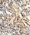 DExD-Box Helicase 39B antibody, A03490-1, Boster Biological Technology, Immunohistochemistry paraffin image 