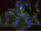 Casein kinase II subunit beta antibody, NBP1-06515, Novus Biologicals, Proximity Ligation Assay image 