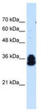 Reticulophagy Regulator 1 antibody, TA335510, Origene, Western Blot image 