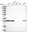 Motile sperm domain-containing protein 3 antibody, HPA048240, Atlas Antibodies, Western Blot image 