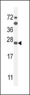 Sodium Voltage-Gated Channel Beta Subunit 1 antibody, PA5-24142, Invitrogen Antibodies, Western Blot image 
