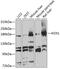 Aldehyde oxidase antibody, GTX64571, GeneTex, Western Blot image 