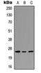 Peroxisomal membrane protein 11C antibody, abx121548, Abbexa, Western Blot image 
