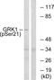 G Protein-Coupled Receptor Kinase 1 antibody, PA5-38496, Invitrogen Antibodies, Western Blot image 