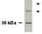 Homeobox protein Nkx-3.1 antibody, TA309766, Origene, Western Blot image 