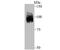 HIF-2-alpha antibody, A01248, Boster Biological Technology, Western Blot image 