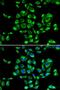 Ribosomal Protein S16 antibody, LS-C346165, Lifespan Biosciences, Immunofluorescence image 