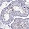 Prostate and testis expressed protein 1 antibody, HPA076587, Atlas Antibodies, Immunohistochemistry paraffin image 