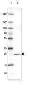 Alpha-N-acetylgalactosaminide alpha-2,6-sialyltransferase 3 antibody, NBP2-31603, Novus Biologicals, Western Blot image 