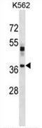 Visual System Homeobox 1 antibody, AP54525PU-N, Origene, Western Blot image 