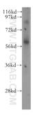Spermatogenesis Associated 2 antibody, 11000-1-AP, Proteintech Group, Western Blot image 