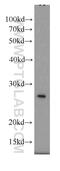Guanidinoacetate N-Methyltransferase antibody, 10880-1-AP, Proteintech Group, Western Blot image 