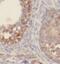Sodium-iodide symporter antibody, FNab08107, FineTest, Immunohistochemistry frozen image 