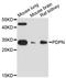 Podoplanin antibody, LS-C748319, Lifespan Biosciences, Western Blot image 
