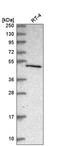 Chromosome 7 Open Reading Frame 26 antibody, HPA042899, Atlas Antibodies, Western Blot image 