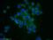 Matrix Metallopeptidase 14 antibody, 14552-1-AP, Proteintech Group, Immunofluorescence image 