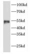 Polycomb protein EED antibody, FNab02640, FineTest, Western Blot image 