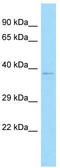 Chromosome 12 Open Reading Frame 10 antibody, TA331377, Origene, Western Blot image 