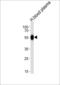 ATIII antibody, LS-C168987, Lifespan Biosciences, Western Blot image 
